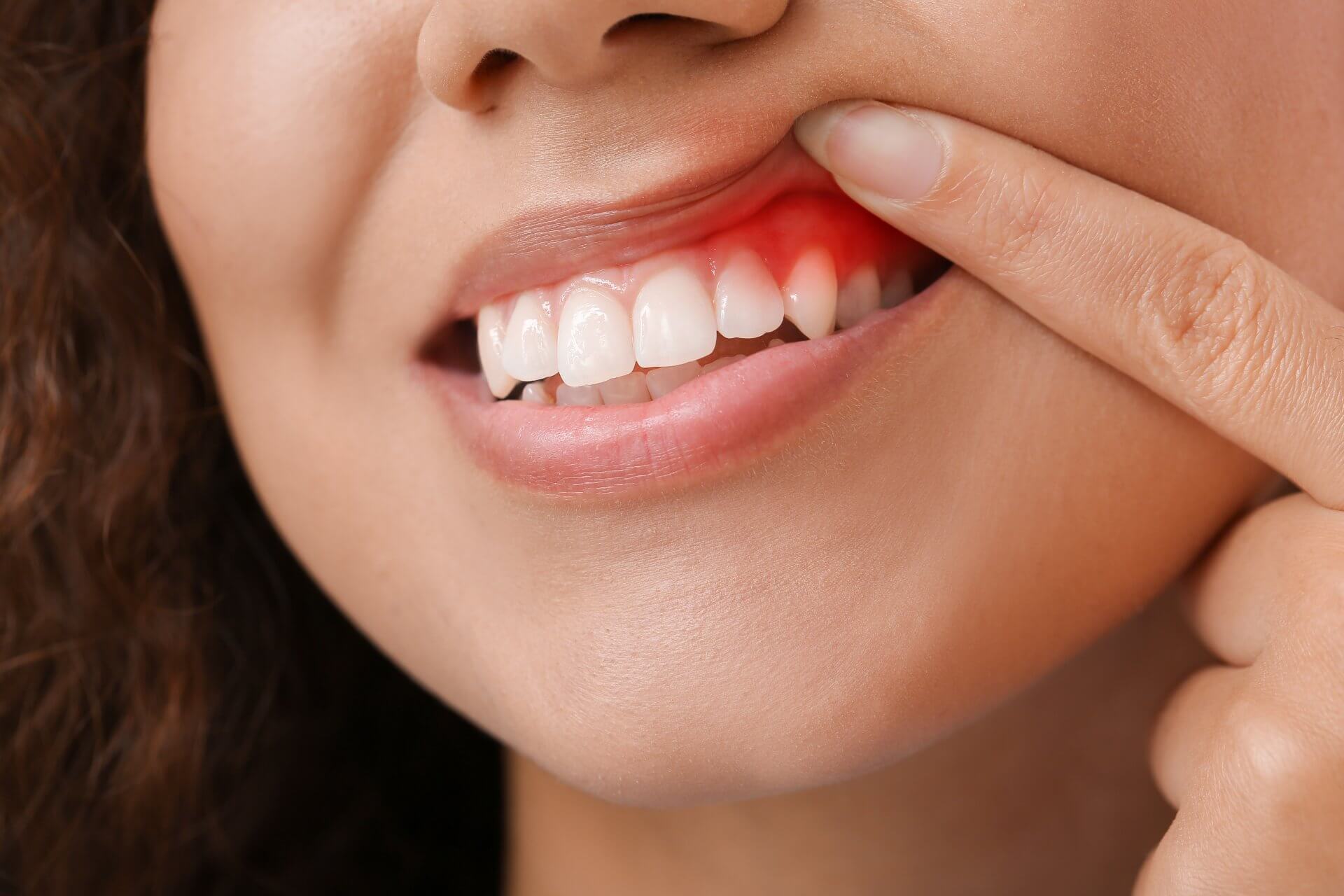 Pacjentka wskazująca na problem z dziąsłami – periodontologia Ez-Dent Oleśnica