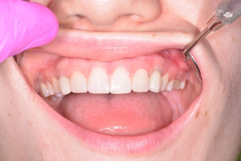 Implantacja, ortodoncja, flow - po